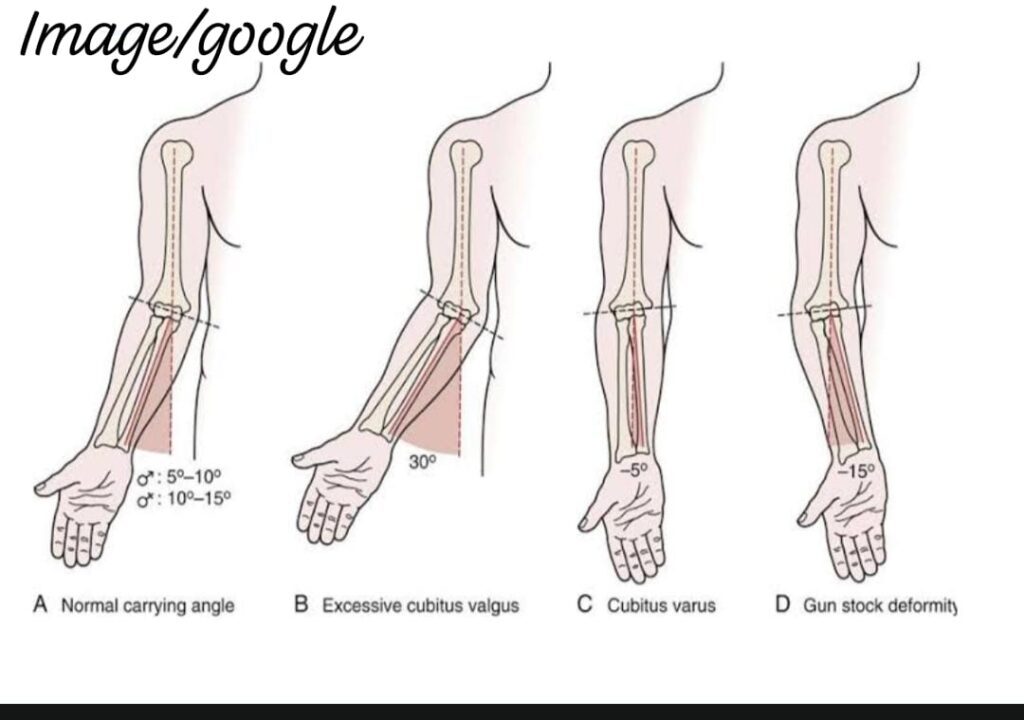 Angles of Elbow Joint
